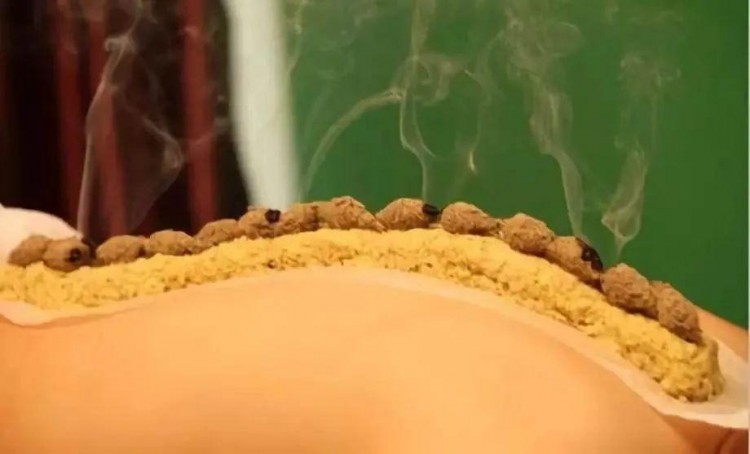 養生季限時免費享受艾灸少兒保健藥療SPA不要錯過