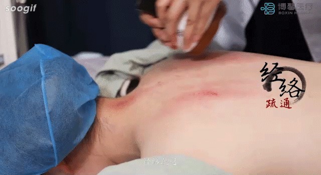 養生季限時免費享受艾灸少兒保健藥療SPA不要錯過