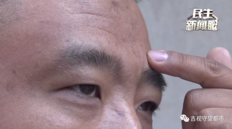 哥倆一心搞事業到長春幸福街纖手美容spa會所去川字紋結果卻變成了大包