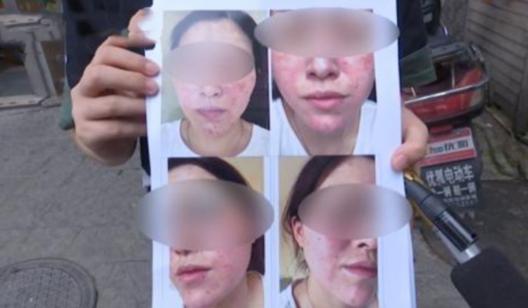 做完面部護理后女子整張臉都腫了美容院：可能是她自己抓的